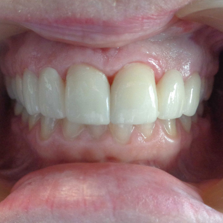 Dentist in Windsor, ON Your Windsor Dental Care