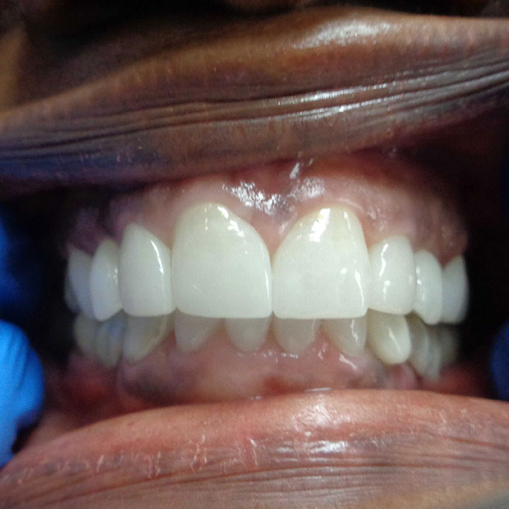 Dentist in Windsor, ON Your Windsor Dental Care