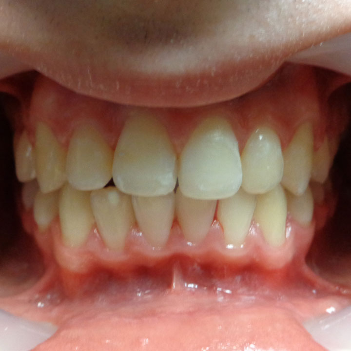 Dentist in Windsor, ON Your Windsor Dental Care