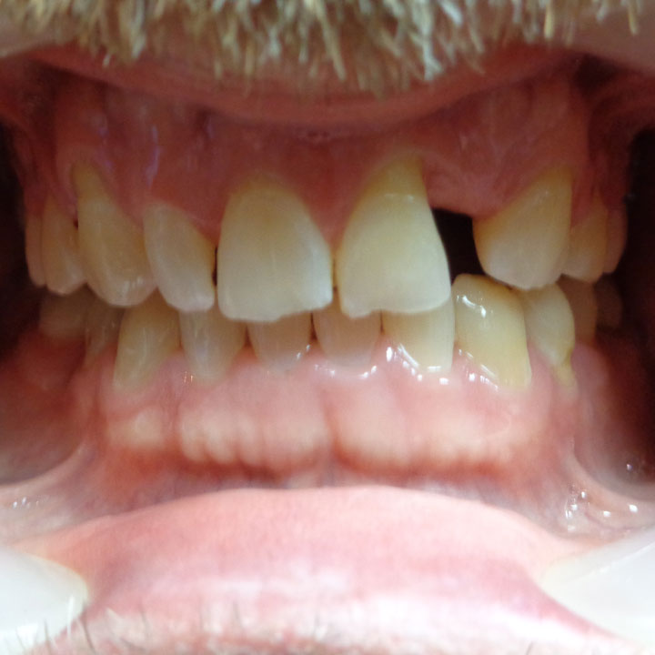 Dentist in Windsor, ON Your Windsor Dental Care